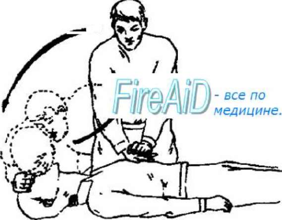 Методичка по оказанию первой помощи - Any2FbImgLoader12