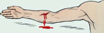 Методичка по оказанию первой помощи - Any2FbImgLoader14