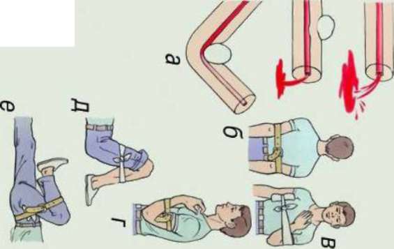 Методичка по оказанию первой помощи - Any2FbImgLoader20